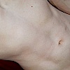 vers