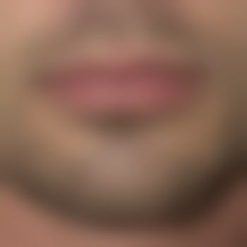 Eproctodile