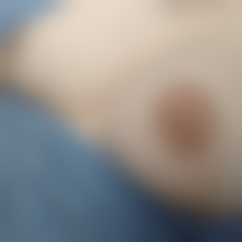 BreastFeedYou
