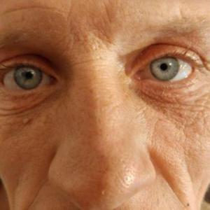 MickeyBlueEyes