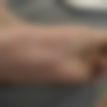 kl74
