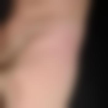 tpro