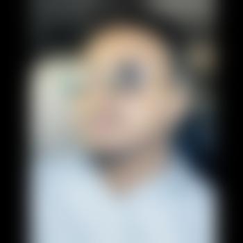 ray_1