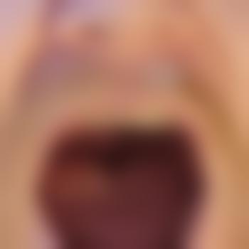 OralSub87