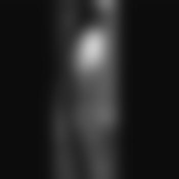 Ostri81