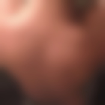 Hernertyp