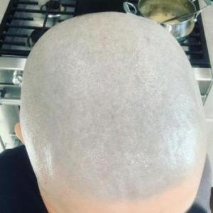 Baldshavefan