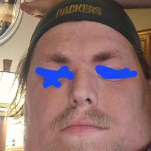 DSMABDL
