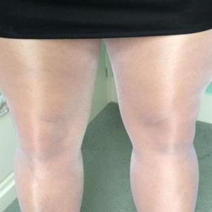 Shinylegs
