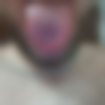 Hairy_Fella