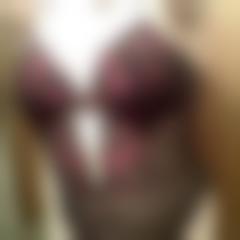 BlemishedBeauty1