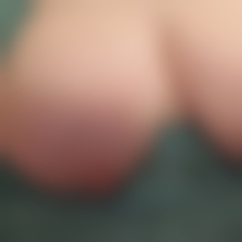CherryTheLast