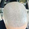 Baldshavefan