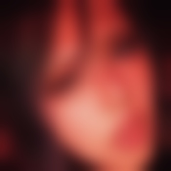 lunnie01